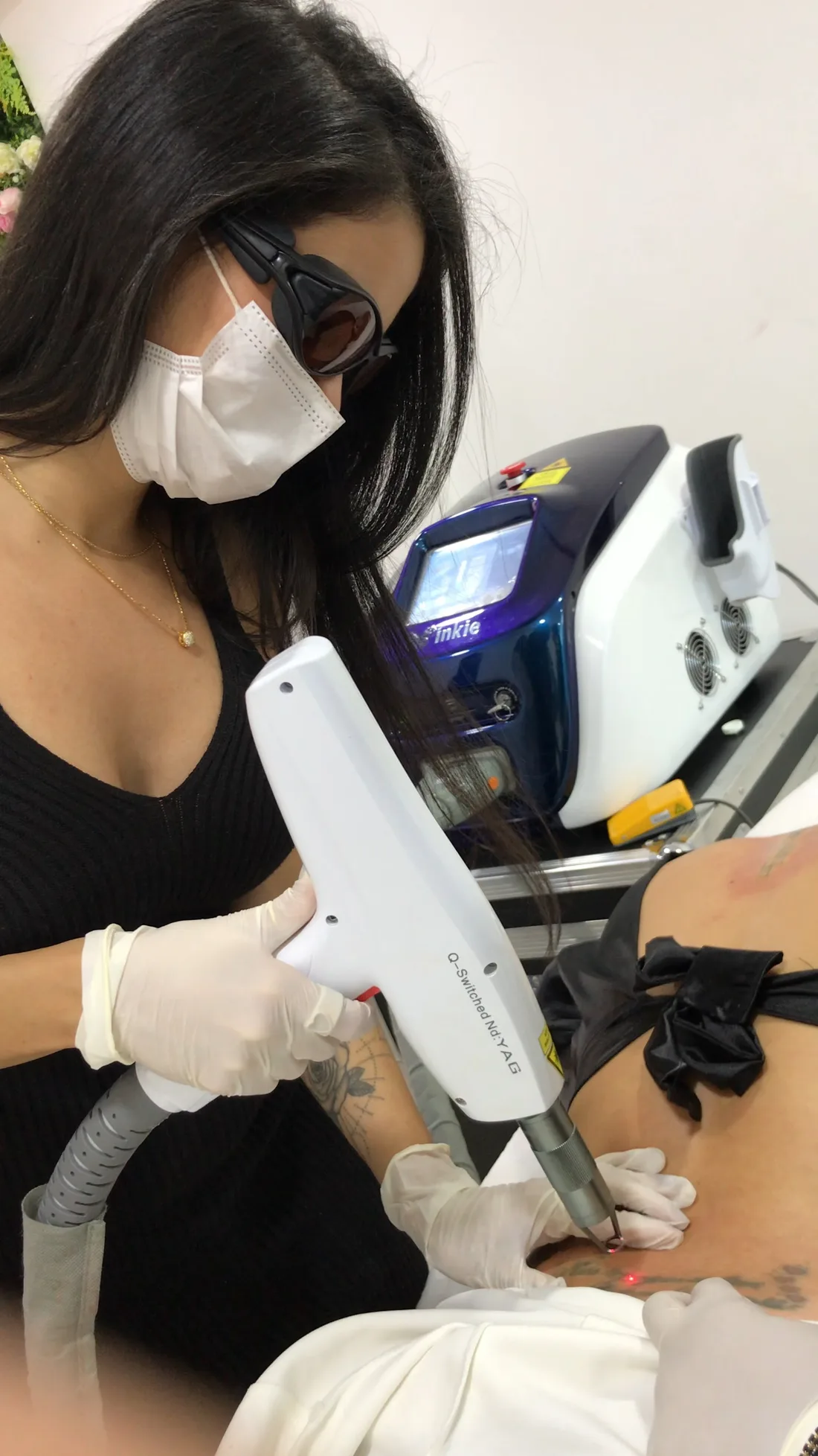 Sessão real de remoção a laser na Clínica Lorena Seppe
